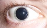Dilated_pupils_2006_(cropped_2)