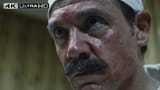 chernobyl_burnedface