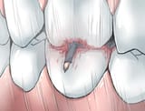 185026 - blood crush drawing ochiko_terada president_matsudo&#039;s_ambition shrunken_man shrunken_men teeth unaware vore