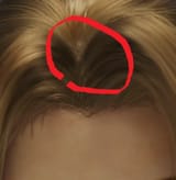 fuckinbald