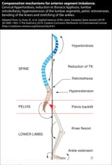sagittal-balance-11-WEB