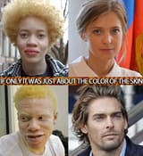 its not about skin color