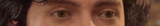 eyeposting