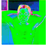 RadiACK