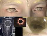 1713420753172339 miquellas eyes