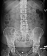 my xray resuls