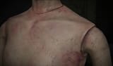 revenant body