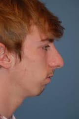 subhuman