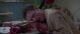 stu bleeding
