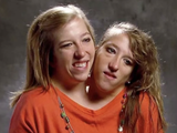 abby-brittany-hensel