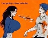 Breast_Reduction