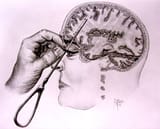 icepick lobotomy