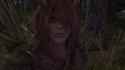 scleraposting_thumb.jpg