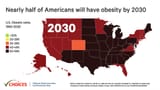 obecity-2030