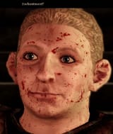 bloody frodo