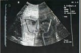 96_75_22_0.50_1.20_0