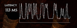 1747417023558119