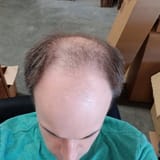 1737386477791529