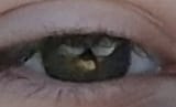 Green eye