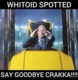Professor X kills you