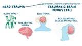 DPS brain