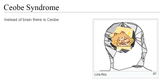 ceobe syndrome