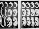 Haeckel_Anthropogenie_1874+43
