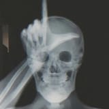 Loser_x-ray