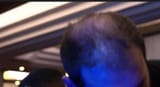 fakehairline