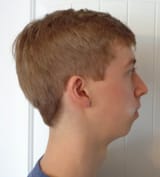 1735644