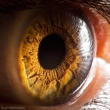 eye