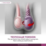Testicular-torsion