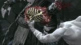 mortal-kombat-xray