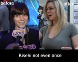 before and after kiseki