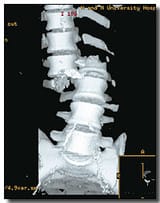 050702spine