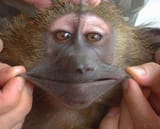 omacacoelastico