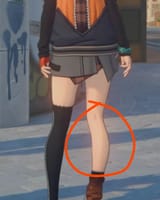deformed legs