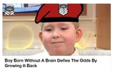 SKKbrain