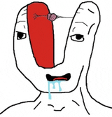 small-brain