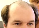 bald