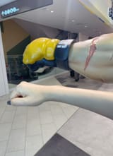 forearm