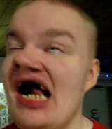 you retard