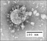 SARS Virus