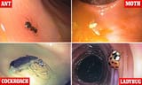 BugsInAnus