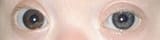 Brushfield_eye_crop