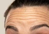 wrinkles
