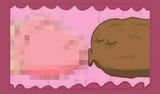 anal