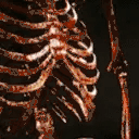 SkeletonBOZO