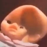 baby-doll-dent