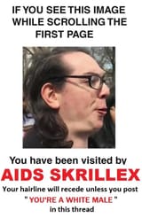 aids skrillex